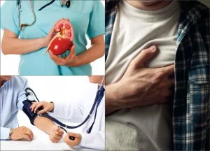 Contraindications