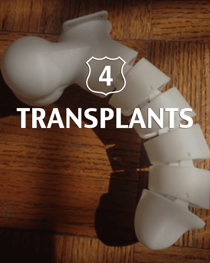 Transplantants Alternative to Viagra