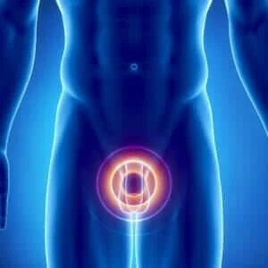 Benign prostatic hyperplasia