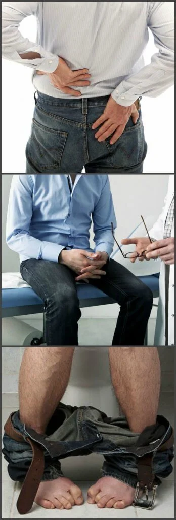 Other urological conditions