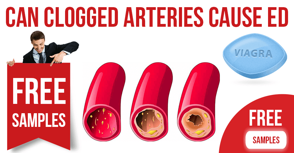 Can Clogged Arteries Cause Erectile Dysfunction