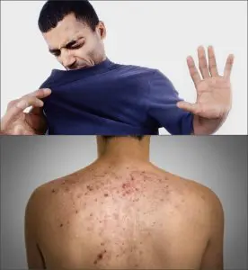 Contraindications of horny goat weed | ViaBestBuy Contraindications of horny goat weed