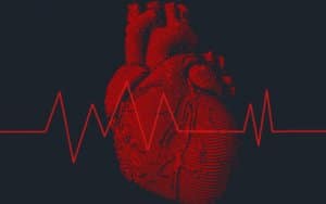 Arrhythmia