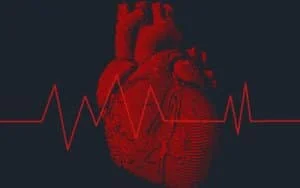Arrhythmia