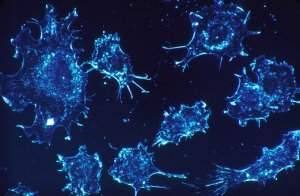 Cancer cells | ViaBestBuy Cancer cells